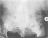 84