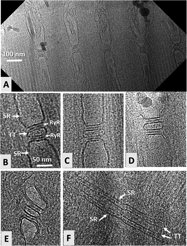 Fig 2.