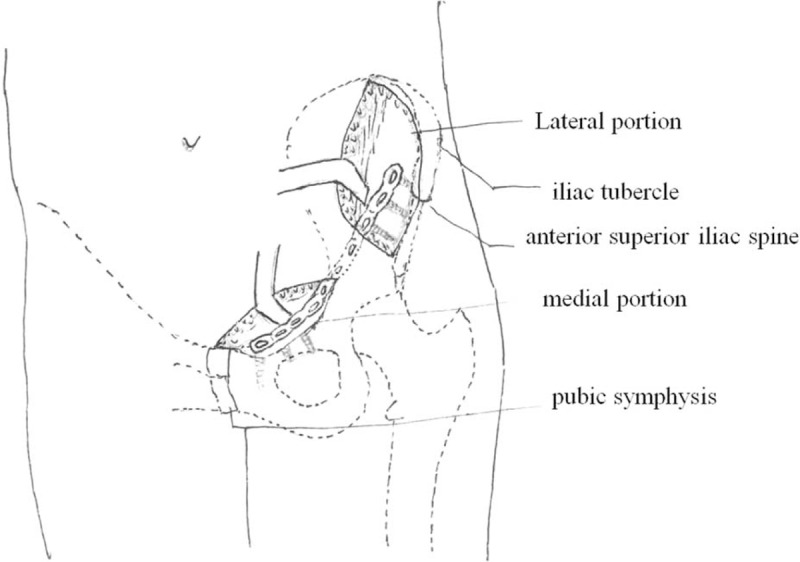 FIGURE 3