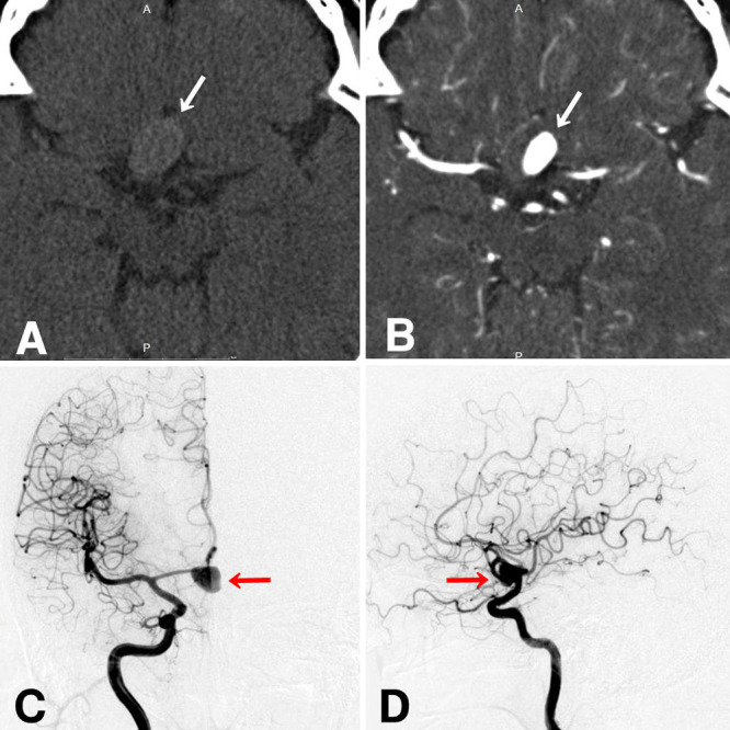 FIG. 1