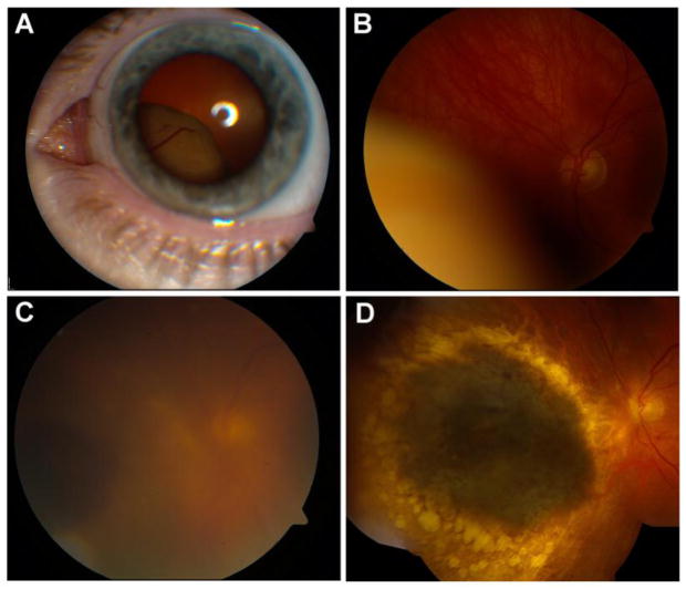 Fig. 1