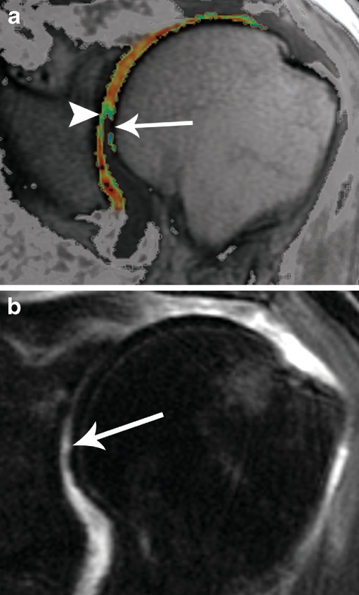 Fig. 5