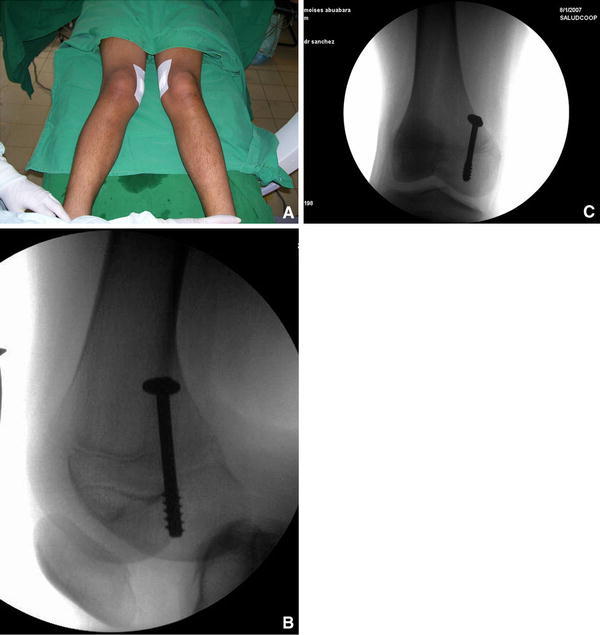 Fig. 4