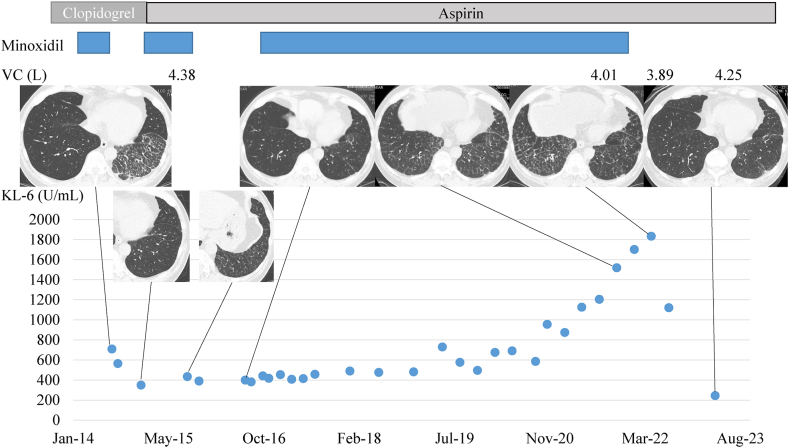 Fig. 3