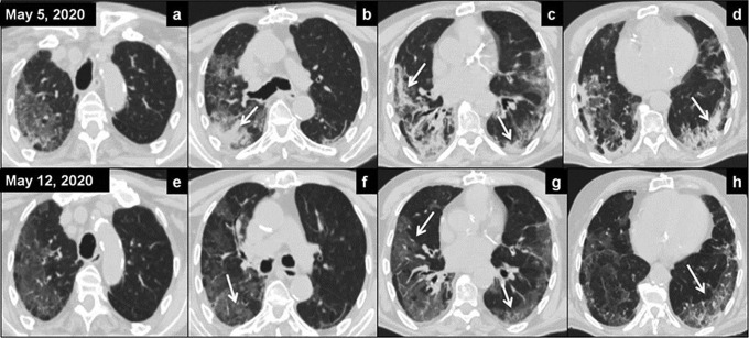 Fig. 2