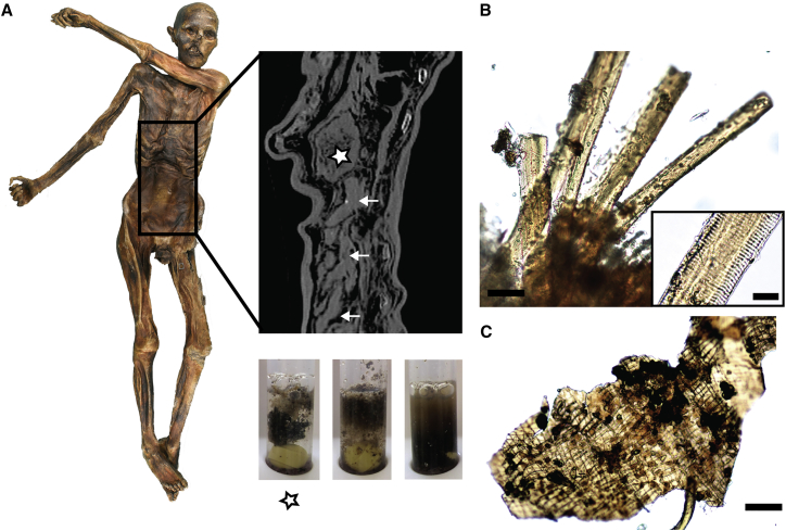 Figure 1