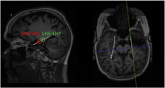 Fig. 1