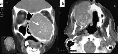 [Table/Fig-9a,b]: