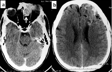 [Table/Fig-8a,b]: