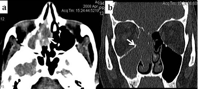 [Table/Fig-5a,b]: