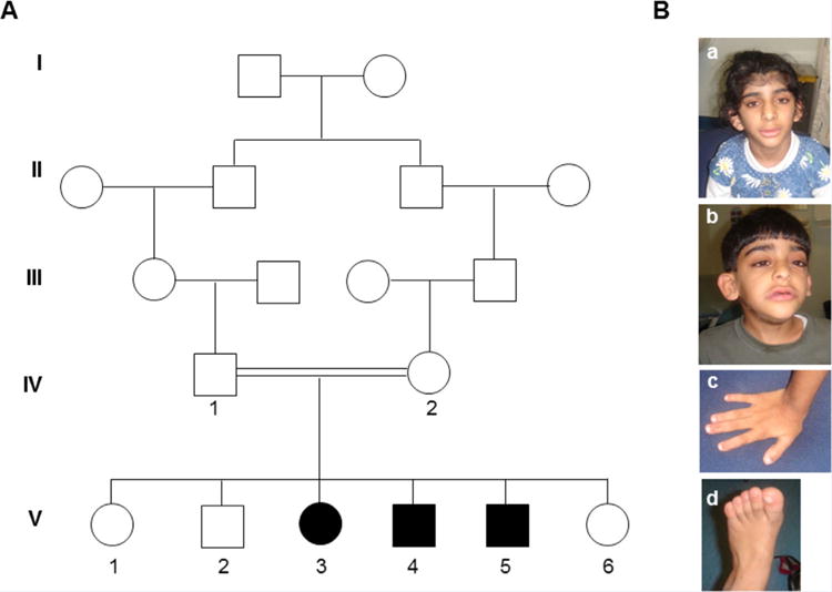 FIG. 1