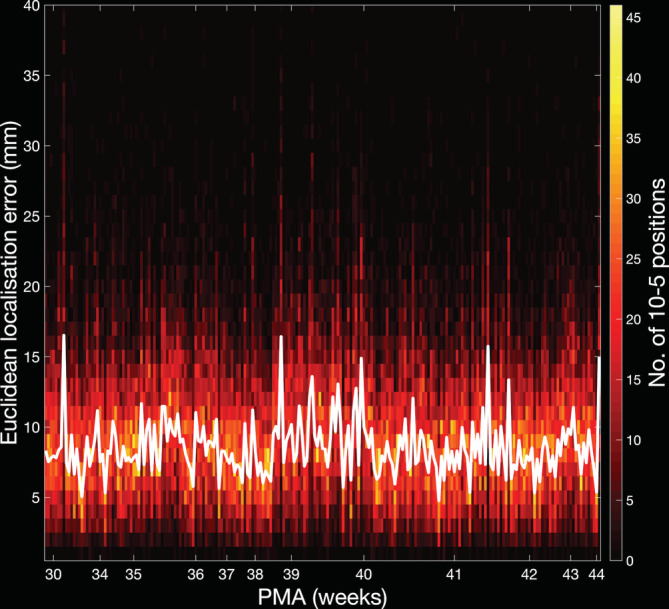 FIGURE 11