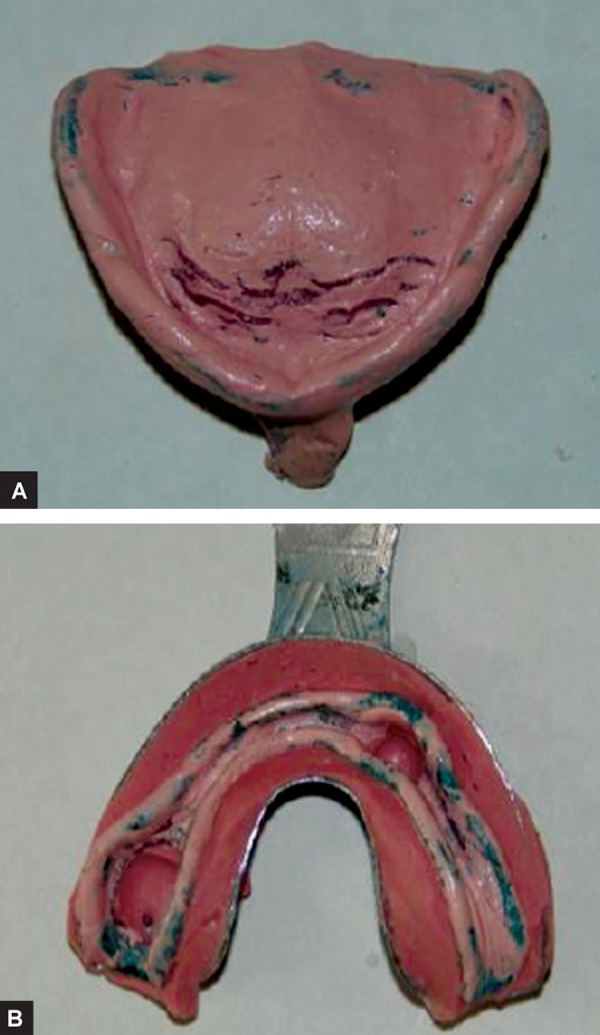 Figs 8A and B: