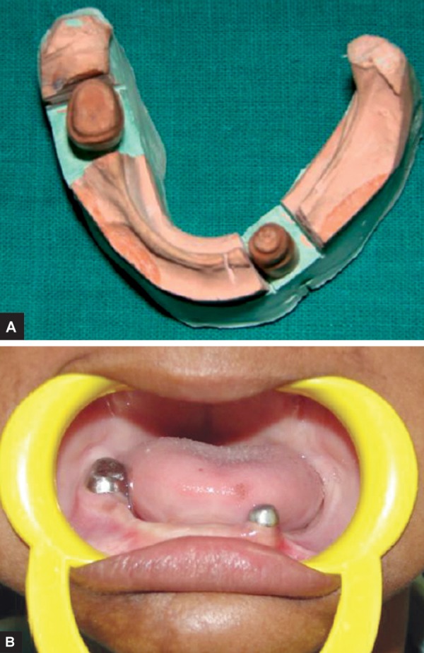 Figs 7A and B: