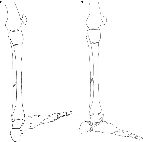 Fig. 11