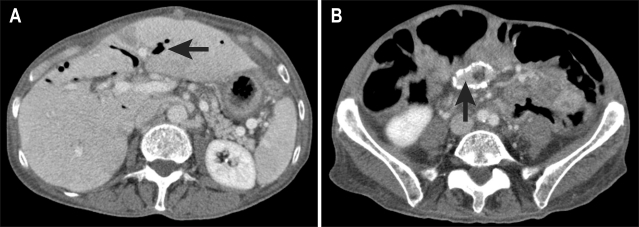 Fig. 11