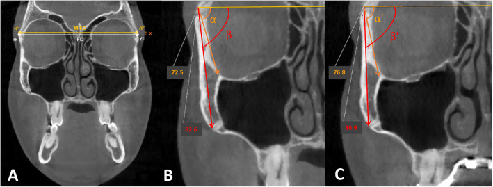 Fig. 6
