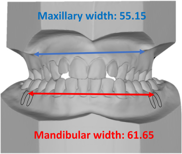 Fig. 2