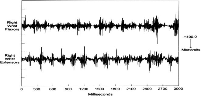 Fig. 9