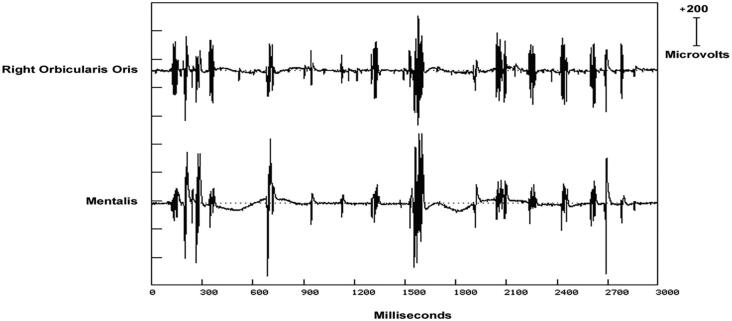 Fig. 12