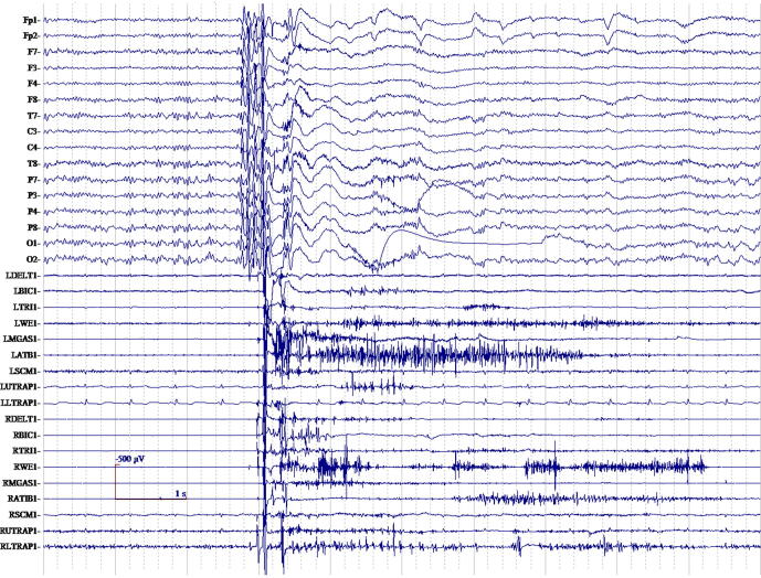 Fig. 7