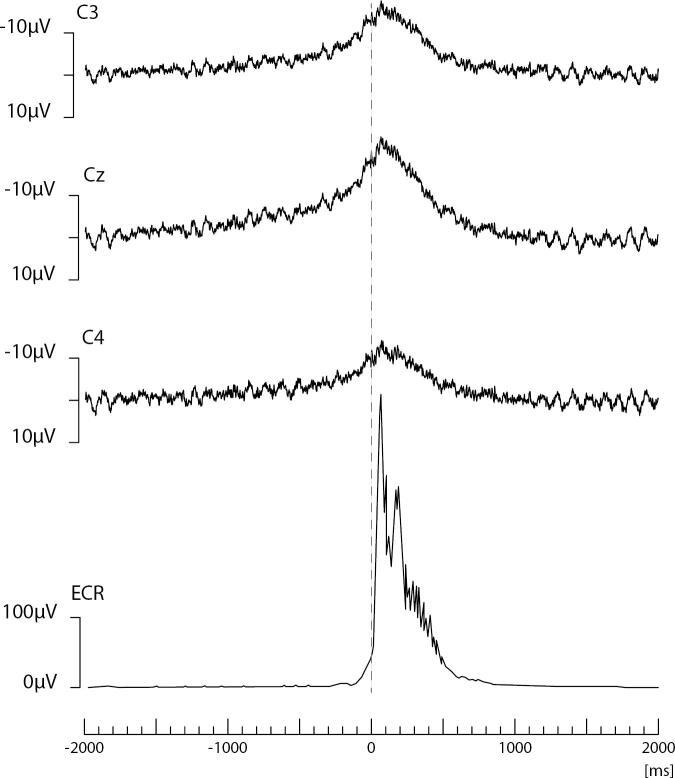 Fig. 11