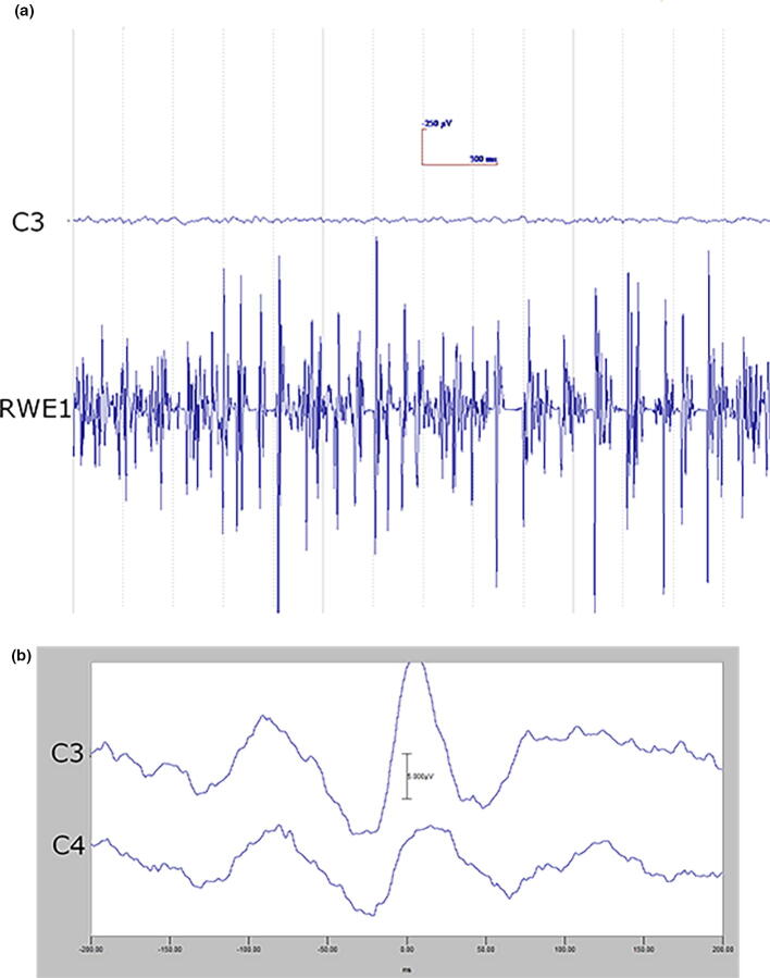 Fig. 4