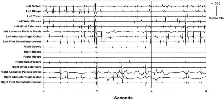 Fig. 3