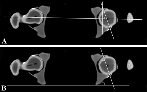 Fig. 3A–B