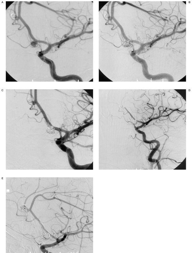 Figure 10