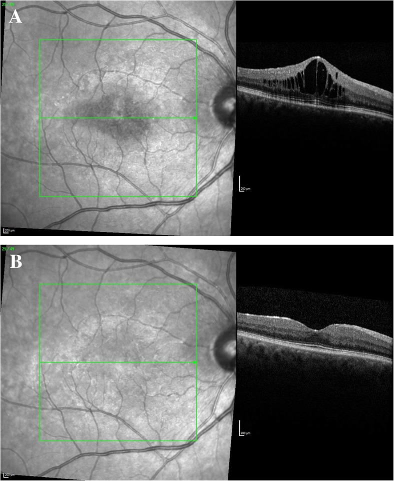 Fig. 1