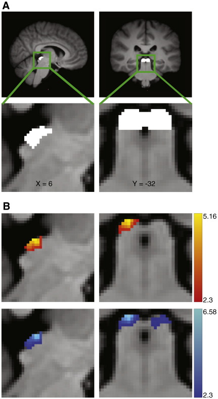 Fig. 3