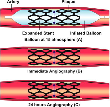 Fig. 1