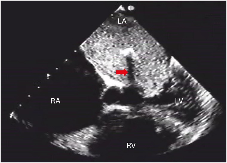 Figure 4