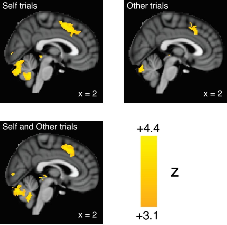 Figure 3—figure supplement 2.