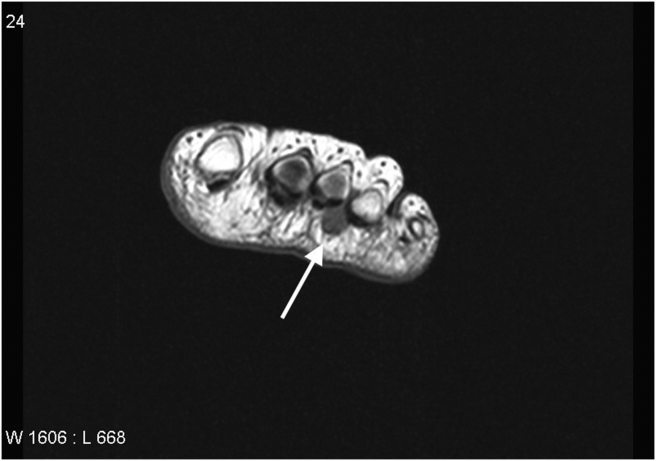 Fig. 2