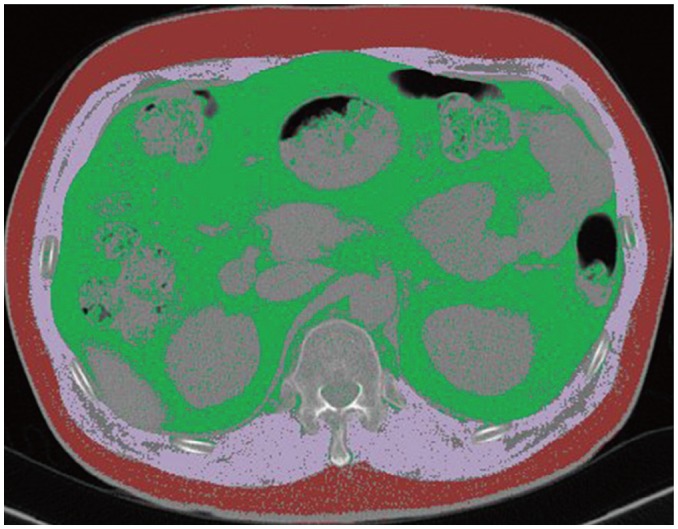 Fig. 2