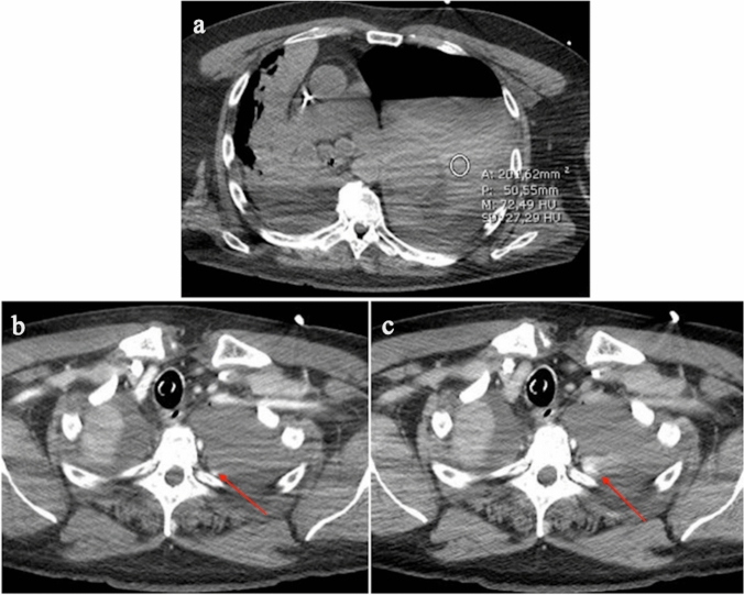 Fig. 6