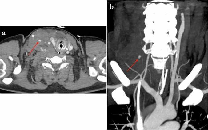 Fig. 7