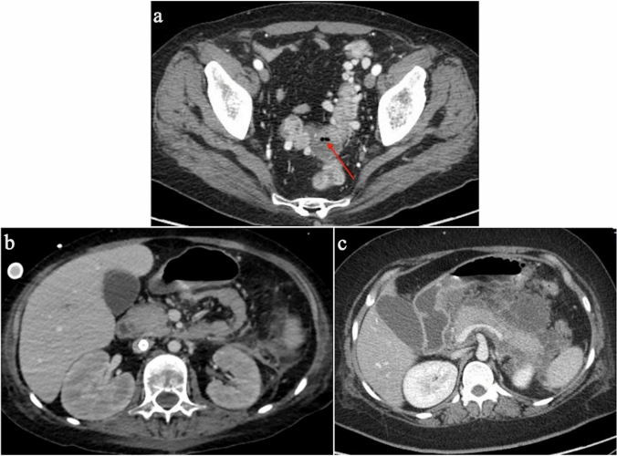 Fig. 9