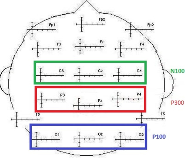 Figure 2