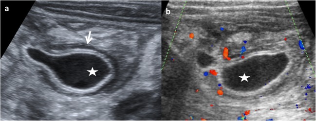 Fig. 14