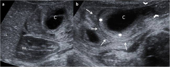 Fig. 15