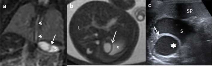 Fig. 16