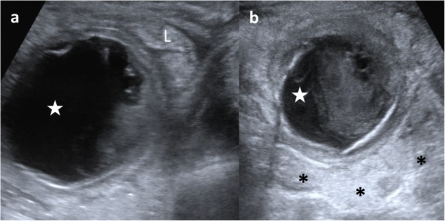 Fig. 13