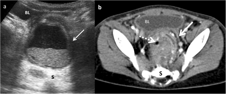 Fig. 17