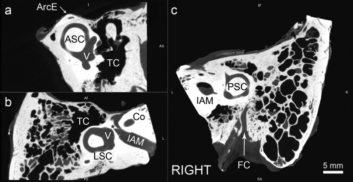 Microtomographic morphometry of the stapedius muscle and its tendon - PMC