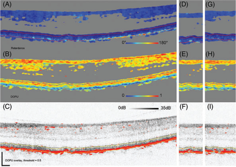 FIGURE 13