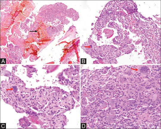 Figure 4 (A-D)