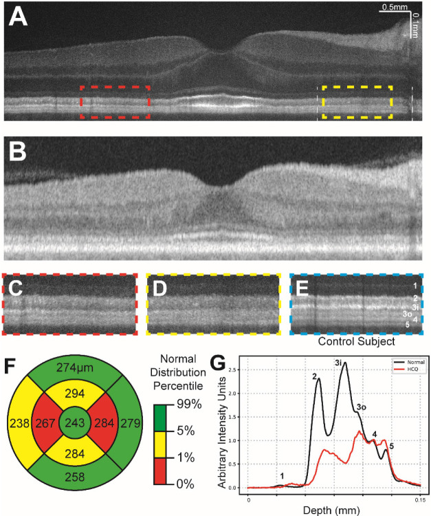 Figure 3: